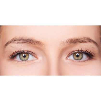 Eyebrow Transplantation Before & After Patient #206