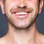 Facial Hair Transplant Before & After Patient #211