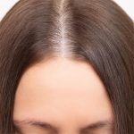 Hair Restoration Before & After Patient #218